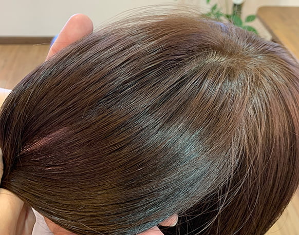 施術中または終了後のホームケアのアドバイスなど