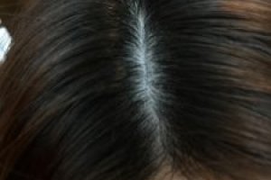 ●美容院で小顔矯正?